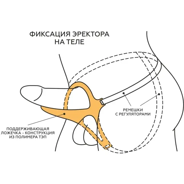 Телесный эректор-ложечка с фиксацией на ремешках MEN STYLE. Фотография 7.